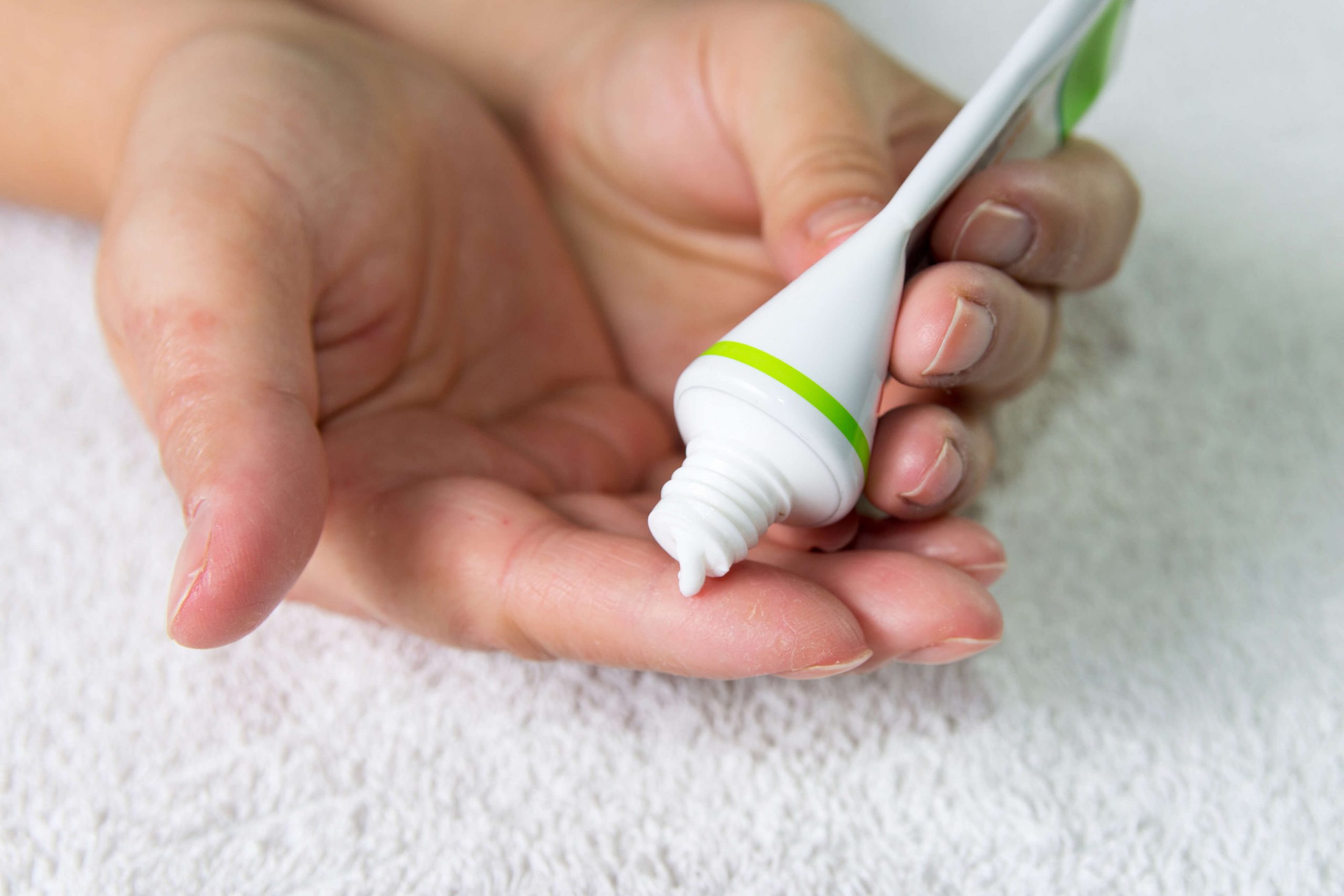 Topical skincare products used for rosacea-prone skin