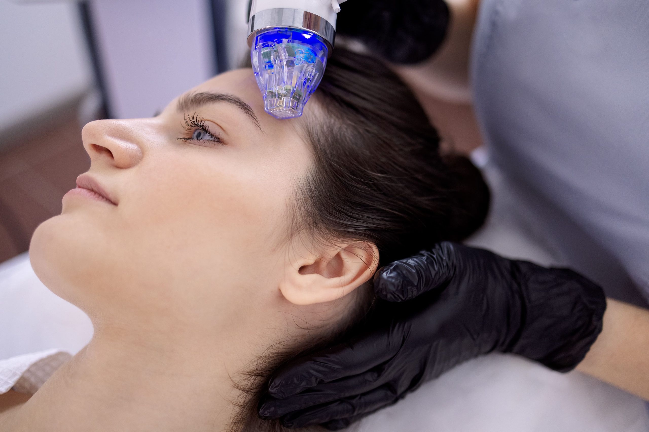microneedling what is scaled