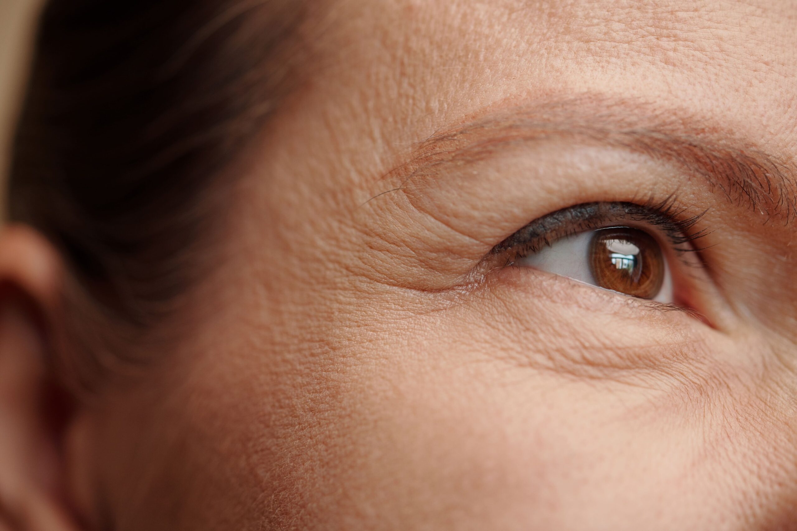 Close-up illustration showing fine lines at the outer eye area
