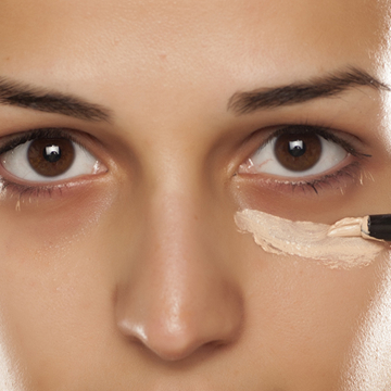 Illustration showing under-eye puffiness and dark circle appearance