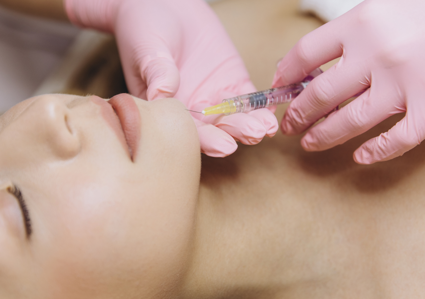 Hyaluronic acid-based injectable aesthetic treatment being administered