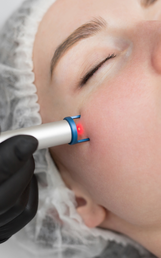 Laser skin treatment procedure shown in a clinical setting