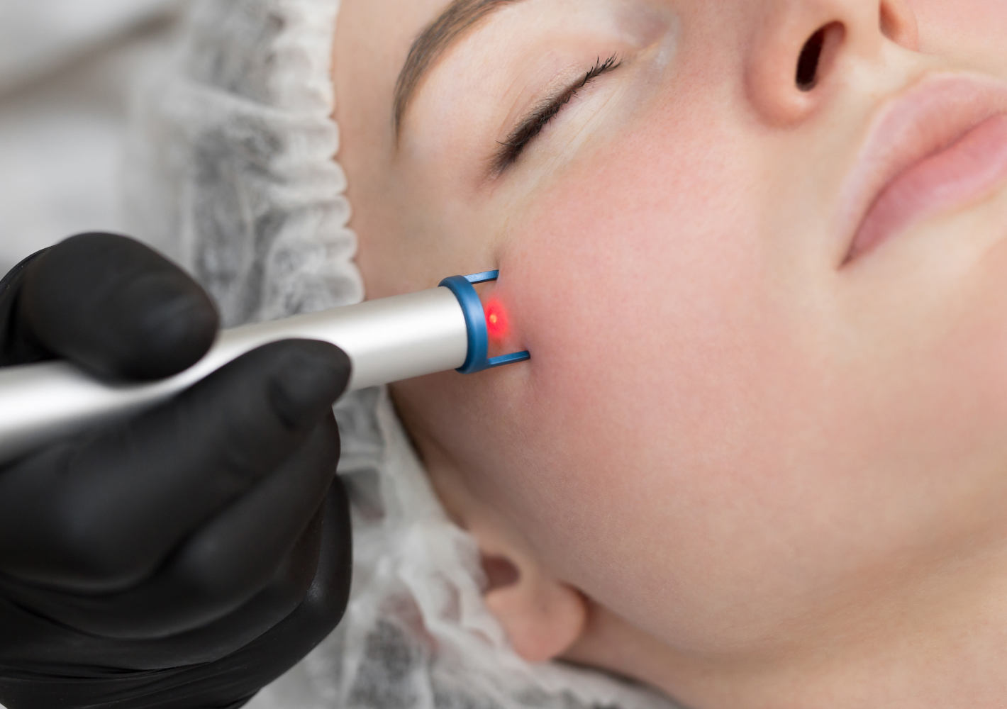 Laser-based skin treatment being carried out by trained clinic staff