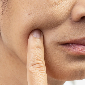 Illustration highlighting areas of facial skin laxity and sagging